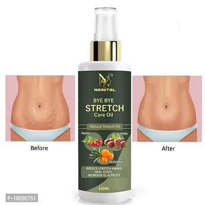 Nainital Advance Repair Stretch Marks Removal - Natural Heal Pregnancy Breast, Hip, Legs, Mark Oil 100 Ml