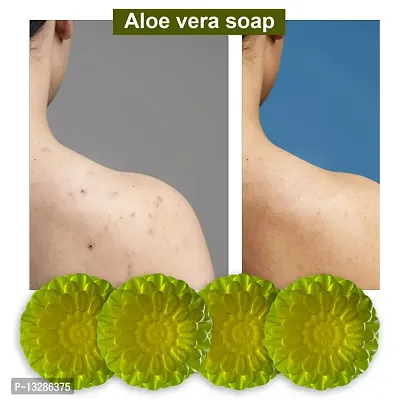 Deep Cleansing Aloe Vera Soap For A Refreshing Bath-100 Grams Each, Pack Of 4-thumb0