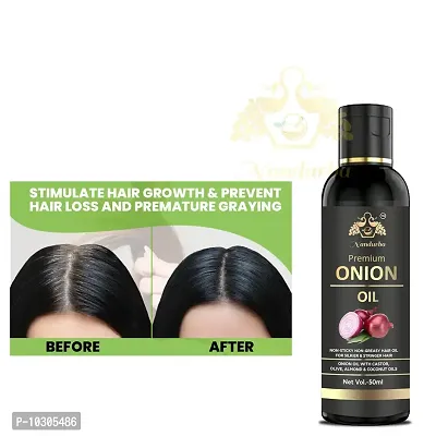 Onion Herbal Hair Oil Blend Of Natural Oils For Increase Hair Growth, Dandruff Control And To Stop Hair Fall