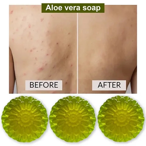 Aloe Vera Soap  Pack Of 3