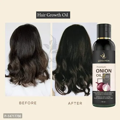 Red Onion Hair Fall Control* Hair Oil ONION HAIR OIL (50ML) (PACK OF 1)-thumb0