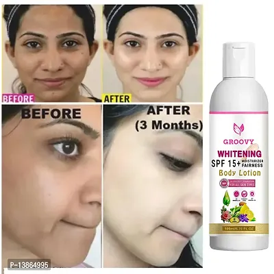 nbsp;Skin Brightening Cream For Face | Body Whitening Cream|Dark Spot Remover (100Gm) With Whitening Cream-thumb3