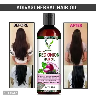 Hair Oil For Hair Fall And Regrowth, Women And Men Hair Oil- 100 Ml