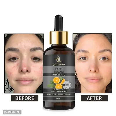 Vitamin C Serum For Face With Hyaluronic Acid For Anti Ageing, Anti Acne  And  Skin Brightening-thumb0