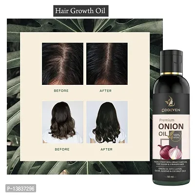 Onion Oil For Hair Growth | All Natural Ingredients | No Any Harmful Chemicals Onion Hair Oil (50Ml) (Pack Of 1)