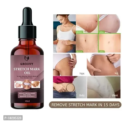 Stretch Marks Oil Stretch Marks Scar Removal Oil In During After Pregnancy Delivery Women,Organic Bio Oil,Anti Cellulite,Remover Scars 40Ml