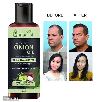 Hair Oil  Black Seed Onion Oil for Damage Control, hair ReGrowth and Hair Fall Control (MEN  WOMEN) Hair Oil 50 ml)