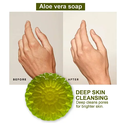 Aloe Vera Soap For Dry Skin-100 Grams Each Multipack