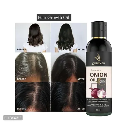 Onion Hair Oil 7 Day Challenge For Hair Growth (Pack Of 1) Onion Hair Oil (50Ml) (Pack Of 1)