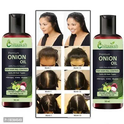 Red Onion Hair Oil - With Deep Root Hair Applicator - Controls Hair Fall And Promotes Growth - Hair Oil 50Ml Pack Of 2-thumb0