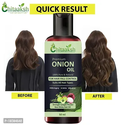 Onion Oil Anti Hair Loss And Hair Growth Oil With Pure Argan, Black Seed Oil In Purest Form Very Effectively Control Hair Loss, Promotes Hair Growth 50Ml-thumb0