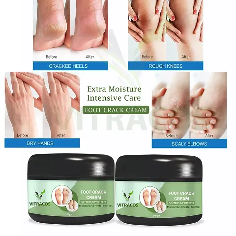 Best Quality Foot Care Cream