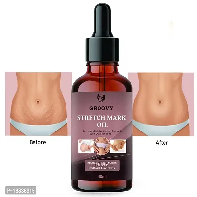 Advance Repair Stretch Marks Removal - Natural Heal Pregnancy Breast, Hip, Legs, Mark Oil 40Ml Ml Pack Of 1-thumb0