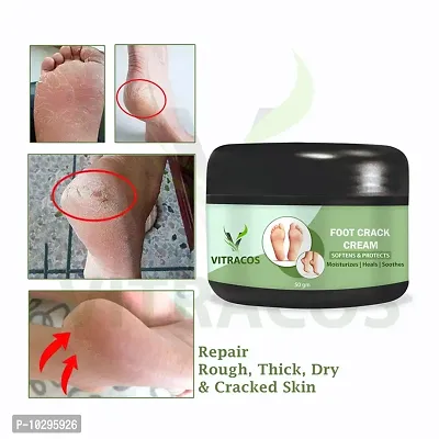 Foot Care Cream For Rough, Dry And Cracked Heel Feet Cream For Heel Repair Healing And Softening Cream 50 Grams