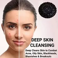 Charcoal Soap For Women Skin Whitening Acne , Blackhead ,- Pack Of 4, 100 Grams Each-thumb2