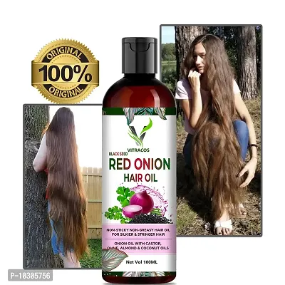 Onion Hair Oil With Vitamin E Natural Oils And Herbs, 100 Ml Hair Oil- 100 Ml