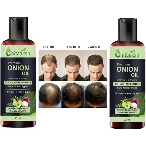 Chitaaksh Onion Oil For Hair Regrowth And Hair Fall Control Pack Of 2