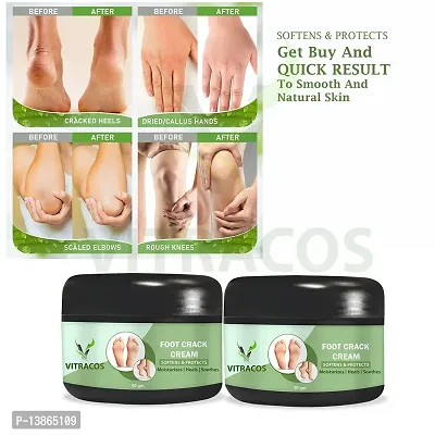 Healthy Feet Treatment Foot Cream | (50Gm With 50Gm) (Pack Of 2)-thumb0