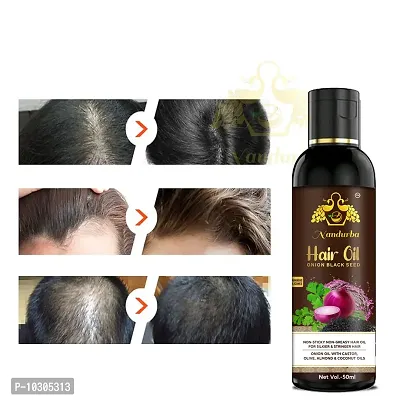Onion Hair Oil For Hair Growth And Anti Dandruff Oil And Onion Shampoo For Men And Women 50Ml For Man And Women-thumb0