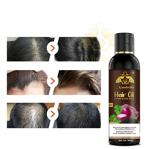Onion Hair Oil For Hair Growth And Anti Dandruff Oil And Onion Shampoo