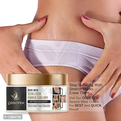 Stretch Marks Cream 1 Pack (50 Gm)