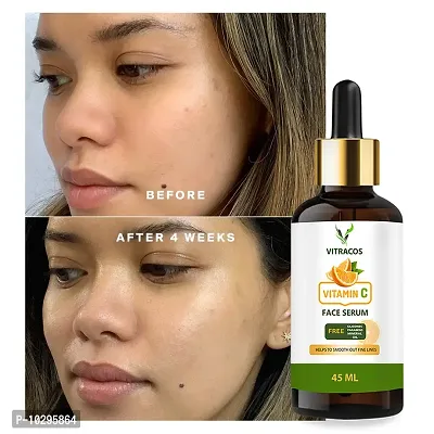 Vitracos Skin Correct Face Serum With Niacinamide And Ginger Extract For Acne Marks And Scars - - 45 Ml - 45 Ml