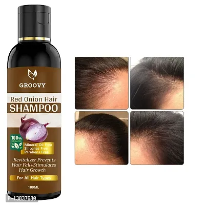 nbsp;Professionals Onion Hair Shampoo With Vitamin E Oil For Hair Fall Control With Hair Oil Applicator Natural Oil, Green Tea For Hair Fall Control - 100 Ml Hair Shampoo 100 Ml)