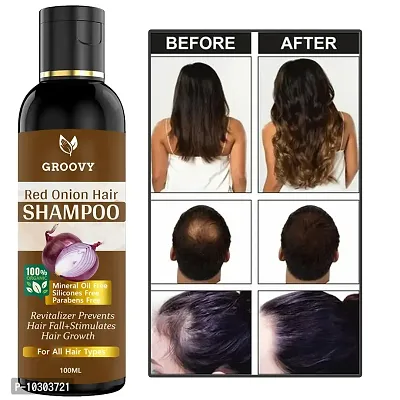 Onion Shampoo - Black Seed Onion Hair Shampoo Hair Shampoo 100 Ml-thumb0