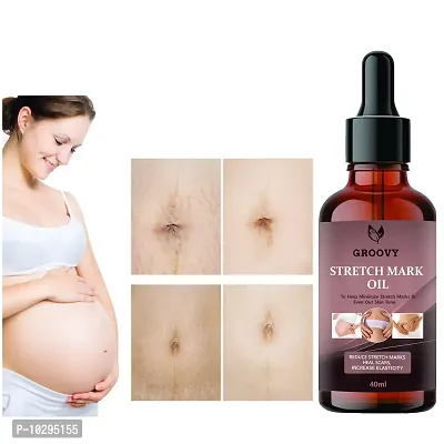 Stretch Marks Oil After Delivery Stretch Mark Removal Oil 40Ml