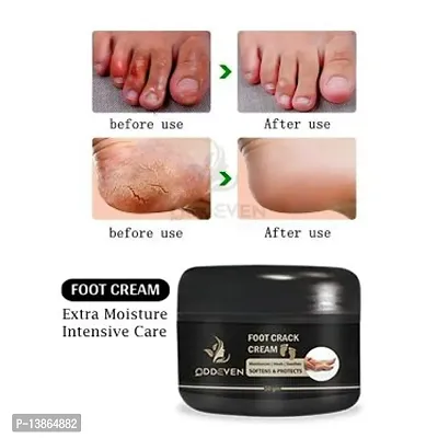 Foot Crack Cream For Dry Cracked Heels And Feet 50 Gm (Pack Of 1)