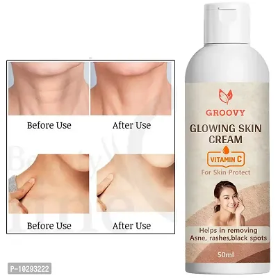 &nbsp;Groovy Whitening Body Lotion Skin Lighten And Brightening Body Lotion Cream-Brightening For Women And Men - 50 ml