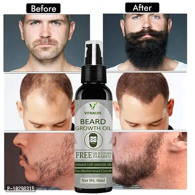 Vitracos Beard Growth Oil For Strong And Healthy Beard Growth Hair Oil- 50 ml