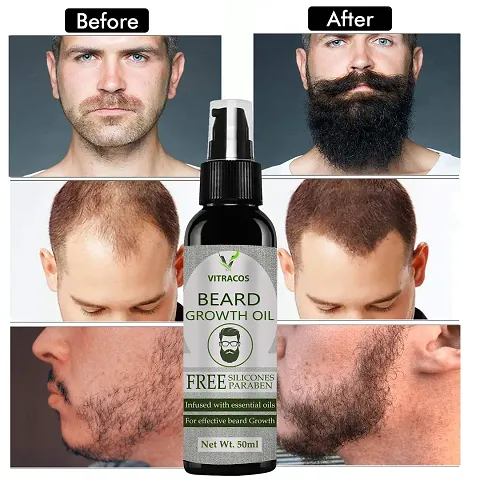 Best Quality Oil Care For Beard Care