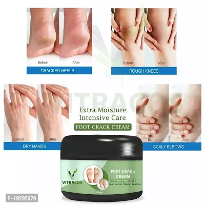 Foot Care Cream Feet Cream For Heel Repair Healing And Softening Cream 50 Grams For Man