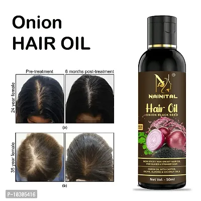 Hair Oil Red Organic Onion Hair Oil For Hair Fall Control 50Ml-thumb0