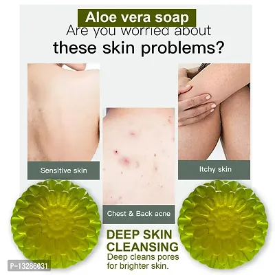 Aloe And Green Tea Cleansing Soap - Pack Of 2, 100 Grams Each-thumb0