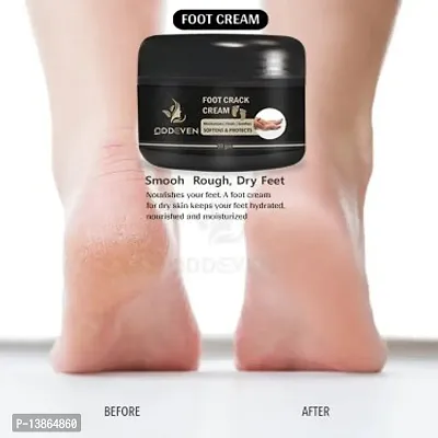 Foot Care Cream  Feet Cream For Heel Repair |Healing And Softening Cream (50 Gm.)-thumb0