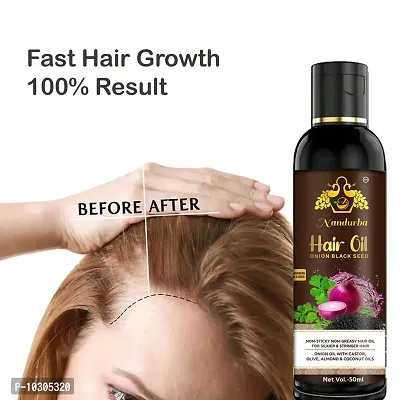 Hair Herbal Oil 50Mlfor Man And Women