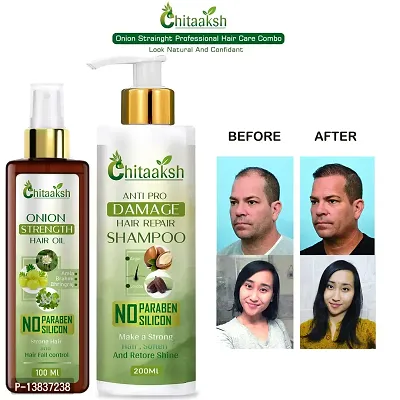 nbsp;Antihairfall Bhringraj Shampoo With Oil For Hairgrowth And Hairfall Controlnbsp;nbsp; (200Ml With 100Ml)