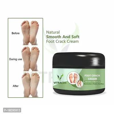 Foot Crack Cream For Women 50 Grams