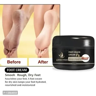 Foot Care Cream For Rough, Dry And Cracked Heel | Feet Cream For Heel Repair |Healing And Softening Cream 50Gm-thumb0