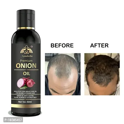 Onion Natural Hair Oil 50Ml