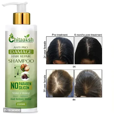 Anti Hair Fall Bhringraj Shampoo 200Ml