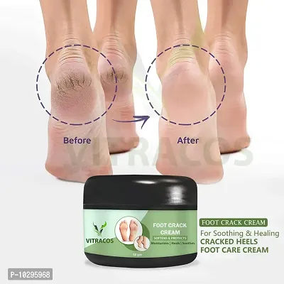 Foot Crack Cream For Dry Cracked Heels And Softening Cream 50 Grams