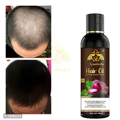 Hair Oil For Hair Growth And Hair Fall Control ,Thiker And Glossier Hair For Men And Women50Ml,