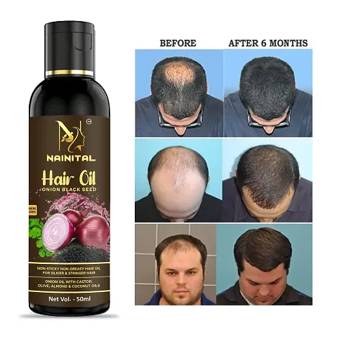 Natural Hair Oil For Hair Growth