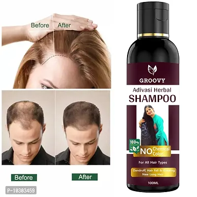 Kasturi Natural Ayurvedic Shampoo Hair Shampoo- 100 Ml-thumb0