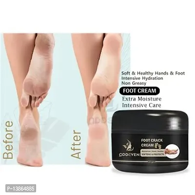 Foot Cream Looking Nutri Height Capsules Darar For Cracked Heels Antiseptic Cream. (50Gm)