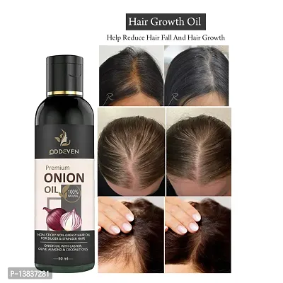 Onion Hair Oil For Hair Growth And Anti Hairfall, 20% Red Onion Extract And Redensyl Onion Hair Oil (50Ml) (Pack Of 1)