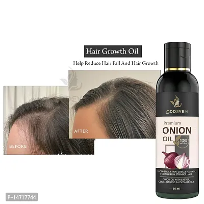 onion methi hair oil ONION HAIR OIL (50ML) (PACK OF 1)-thumb0